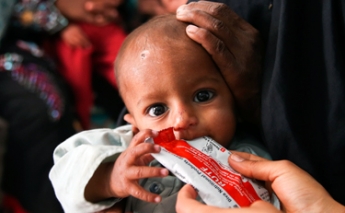Treating Acute Malnutrition: UNICEF